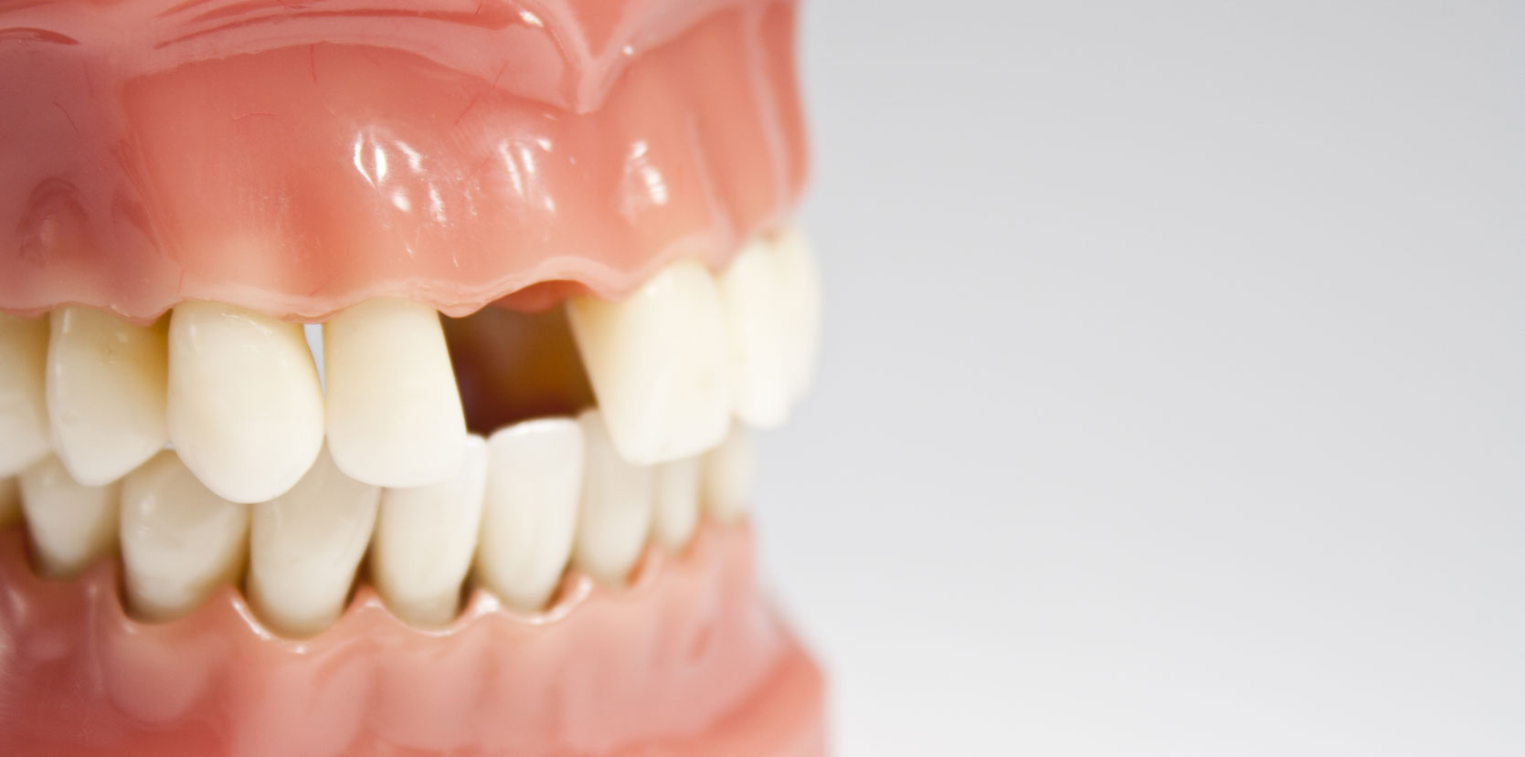 Tooth and Bone Loss Hixson, TN